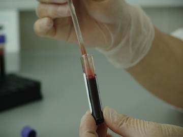 Blood analysis in  a laboratory